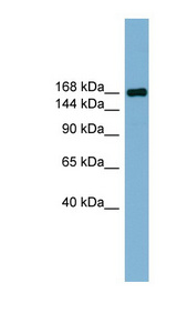 PARD3 Antibody - PARD3 antibody Western blot of Fetal Thymus lysate. This image was taken for the unconjugated form of this product. Other forms have not been tested.