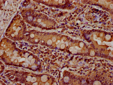 PARD3 Antibody - IHC image of PARD3 Antibody diluted at 1:600 and staining in paraffin-embedded human small intestine tissue performed on a Leica BondTM system. After dewaxing and hydration, antigen retrieval was mediated by high pressure in a citrate buffer (pH 6.0). Section was blocked with 10% normal goat serum 30min at RT. Then primary antibody (1% BSA) was incubated at 4°C overnight. The primary is detected by a biotinylated secondary antibody and visualized using an HRP conjugated SP system.
