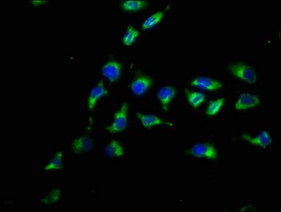 PARD3 Antibody - Immunofluorescence staining of A549 cells with PARD3 Antibody at 1:200, counter-stained with DAPI. The cells were fixed in 4% formaldehyde, permeabilized using 0.2% Triton X-100 and blocked in 10% normal Goat Serum. The cells were then incubated with the antibody overnight at 4°C. The secondary antibody was Alexa Fluor 488-congugated AffiniPure Goat Anti-Rabbit IgG(H+L).