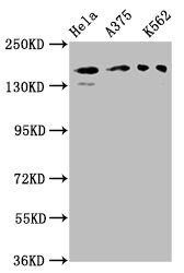 PARD3 Antibody - Western Blot Positive WB detected in: Hela whole cell lysate, A375 whole cell lysate, K562 whole cell lysate All lanes: PARD3 antibody at 3µg/ml Secondary Goat polyclonal to rabbit IgG at 1/50000 dilution Predicted band size: 152 kDa Observed band size: 152 kDa