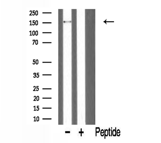 PARD3 Antibody - Western blot analysis of extracts of mouse brain tissue using PARD3 antibody.