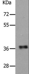 PARD6A / PAR6 Antibody - Western blot analysis of Human fetal muscle tissue, using PARD6A Polyclonal Antibody at dilution of 1:650.