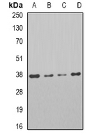 PARD6A / PAR6 Antibody - Western blot analysis of PAR6A expression in HT29 (A); Jurkat (B); Raji (C); mouse testis (D) whole cell lysates.