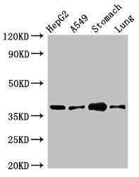 PARD6A / PAR6 Antibody - Western Blot Positive WB detected in:HepG2 whole cell lysate,A549 whole cell lysate,Mouse stomach tissue,Mouse lung tissue All Lanes:PARD6A antibody at 2.5µg/ml Secondary Goat polyclonal to rabbit IgG at 1/50000 dilution Predicted band size: 38 KDa Observed band size: 38 KDa