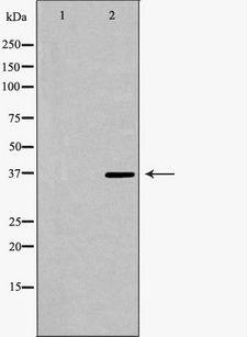 PARD6A / PAR6 Antibody - Western blot analysis of extracts of 193T using PARD6A antibody. The lane on the left is treated with the antigen-specific peptide.