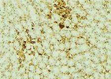 PARD6A / PAR6 Antibody - 1:100 staining mouse kidney tissue by IHC-P. The sample was formaldehyde fixed and a heat mediated antigen retrieval step in citrate buffer was performed. The sample was then blocked and incubated with the antibody for 1.5 hours at 22°C. An HRP conjugated goat anti-rabbit antibody was used as the secondary.