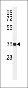 PARD6G Antibody - Western blot of PAR6G Antibody in ZR-75-1 cell line lysates (35 ug/lane). PAR6G (arrow) was detected using the purified antibody.
