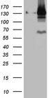 PARG Antibody - HEK293T cells were transfected with the pCMV6-ENTRY control. (Left lane) or pCMV6-ENTRY PARG. (Right lane) cDNA for 48 hrs and lysed