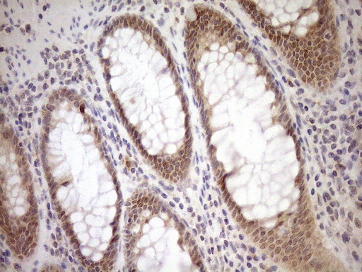 PARG Antibody - Immunohistochemical staining of paraffin-embedded Human colon tissue within the normal limits using anti-PARG mouse monoclonal antibody. (Heat-induced epitope retrieval by 1mM EDTA in 10mM Tris buffer. (pH8.5) at 120°C for 3 min. (1:150)