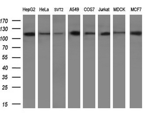 PARG Antibody - Western blot analysis of extracts. (10ug) from 8 different cell lines by using anti-PARG monoclonal antibody. (1:200)