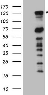 PARG Antibody - HEK293T cells were transfected with the pCMV6-ENTRY control. (Left lane) or pCMV6-ENTRY PARG. (Right lane) cDNA for 48 hrs and lysed. Equivalent amounts of cell lysates. (5 ug per lane) were separated by SDS-PAGE and immunoblotted with anti-PARG. (1:2000)