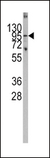 PARG Antibody - Western blot of Parg (arrow) using rabbit polyclonal Parg Antibody. 293 cell lysates (2 ug/lane) either nontransfected (Lane 1) or transiently transfected with the Parg gene (Lane 2) (Origene Technologies).