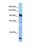 PARG Antibody - PARG antibody Western blot of Jurkat Cell lysate. Antibody concentration 1 ug/ml.  This image was taken for the unconjugated form of this product. Other forms have not been tested.