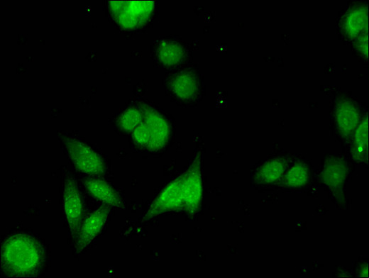 PARG Antibody - Immunofluorescent analysis of PC3 cells using PARG Antibody at a dilution of 1:100 and Alexa Fluor 488-congugated AffiniPure Goat Anti-Rabbit IgG(H+L)