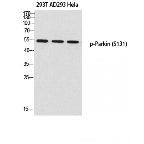 PARK2 / Parkin 2 Antibody - Western blot of Phospho-Parkin (S131) antibody