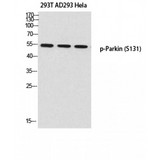 PARK2 / Parkin 2 Antibody - Western blot of Phospho-Parkin (S131) antibody