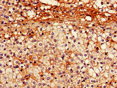 PARK2 / Parkin 2 Antibody - IHC image of PARK2 Antibody diluted at 1:600 and staining in paraffin-embedded human adrenal gland tissue performed on a Leica BondTM system. After dewaxing and hydration, antigen retrieval was mediated by high pressure in a citrate buffer (pH 6.0). Section was blocked with 10% normal goat serum 30min at RT. Then primary antibody (1% BSA) was incubated at 4°C overnight. The primary is detected by a biotinylated secondary antibody and visualized using an HRP conjugated SP system.