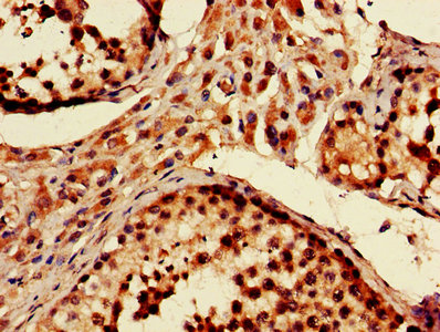 PARK2 / Parkin 2 Antibody - IHC image of PARK2 Antibody diluted at 1:600 and staining in paraffin-embedded human testis tissue performed on a Leica BondTM system. After dewaxing and hydration, antigen retrieval was mediated by high pressure in a citrate buffer (pH 6.0). Section was blocked with 10% normal goat serum 30min at RT. Then primary antibody (1% BSA) was incubated at 4°C overnight. The primary is detected by a biotinylated secondary antibody and visualized using an HRP conjugated SP system.