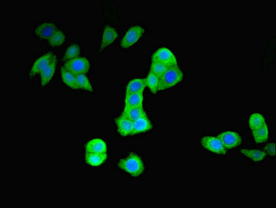 PARK2 / Parkin 2 Antibody - Immunofluorescent analysis of PC-3 cells using PARK2 Antibody at dilution of 1:100 and Alexa Fluor 488-congugated AffiniPure Goat Anti-Rabbit IgG(H+L)