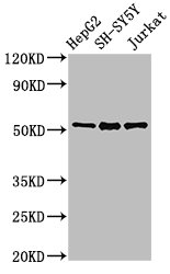 PARK2 / Parkin 2 Antibody - Western Blot Positive WB detected in: HepG2 whole cell lysate, SH-SY5Y whole cell lysate, Jurkat whole cell lysate All lanes: PARK2 antibody at 3µg/ml Secondary Goat polyclonal to rabbit IgG at 1/50000 dilution Predicted band size: 52, 49, 24, 31, 43, 36, 44, 47 kDa Observed band size: 52 kDa