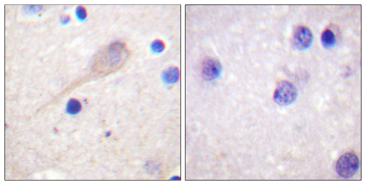 PARK2 / Parkin 2 Antibody - Immunohistochemistry analysis of paraffin-embedded human brain tissue, using Parkin Antibody. The picture on the right is blocked with the synthesized peptide.