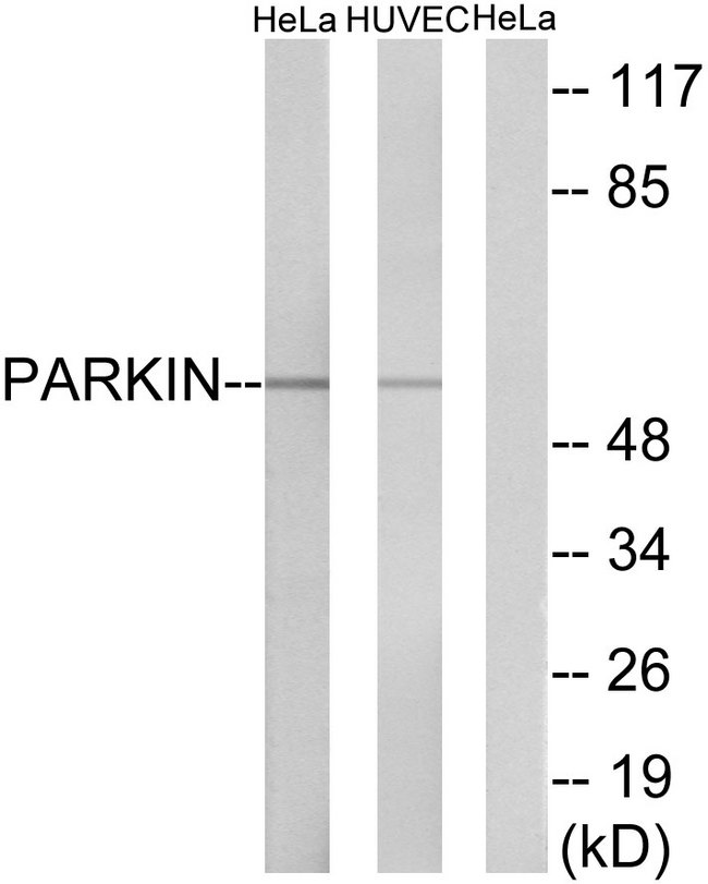 PARK2 / Parkin 2 Antibody - Western blot analysis of lysates from HeLa and HUVEC cells, using Parkin Antibody. The lane on the right is blocked with the synthesized peptide.
