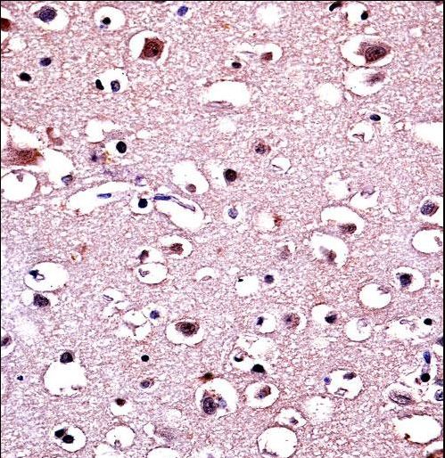 PARK2 / Parkin 2 Antibody - Parkin Antibody immunohistochemistry of formalin-fixed and paraffin-embedded human brain tissue followed by peroxidase-conjugated secondary antibody and DAB staining.