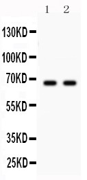 PARK2 / Parkin 2 Antibody - Parkin antibody Western blot. All lanes: Anti Parkin at 0.5 ug/ml. Lane 1: U87 Whole Cell Lysate at 40 ug. Lane 2: Mouse Brain Tissue Lysate at 50 ug. Predicted band size: 66 kD. Observed band size: 66 kD.
