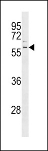 PARK2 / Parkin 2 Antibody - The anti-Parkin antibody is used in Western blot to detect Parkin in mouse kidney tissue lysate.