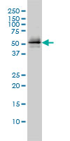 PARK2 / Parkin 2 Antibody - PARK2 monoclonal antibody (M01), clone 1H4 Western Blot analysis of PARK2 expression in Jurkat.