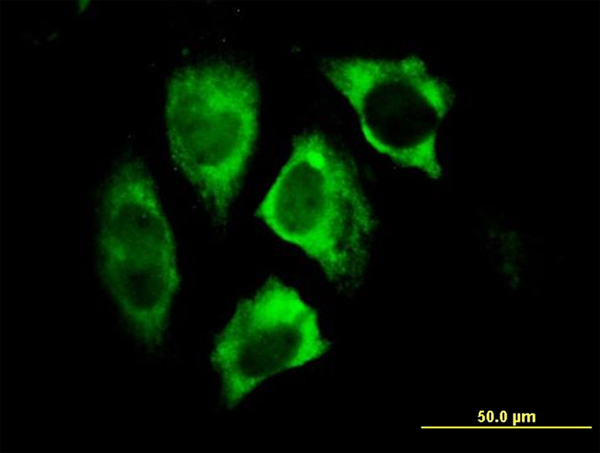 PARK2 / Parkin 2 Antibody - Immunofluorescence of monoclonal antibody to PARK2 on HeLa cell. [antibody concentration 10 ug/ml]