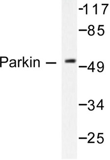 PARK2 / Parkin 2 Antibody - Western blot of Parkin (G12) pAb in extracts from Jurkat cells.