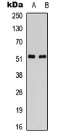 PARK2 / Parkin 2 Antibody - Western blot analysis of Parkin expression in SHSY5Y (A); HUVEC (B) whole cell lysates.