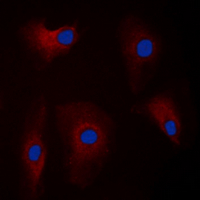 PARK2 / Parkin 2 Antibody - Immunofluorescent analysis of Parkin staining in U87MG cells. Formalin-fixed cells were permeabilized with 0.1% Triton X-100 in TBS for 5-10 minutes and blocked with 3% BSA-PBS for 30 minutes at room temperature. Cells were probed with the primary antibody in 3% BSA-PBS and incubated overnight at 4 deg C in a humidified chamber. Cells were washed with PBST and incubated with a DyLight 594-conjugated secondary antibody (red) in PBS at room temperature in the dark. DAPI was used to stain the cell nuclei (blue).