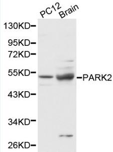 PARK2 / Parkin 2 Antibody - Western blot of PARK2 pAb in extracts from PC12 cells and mouse brain tissue.