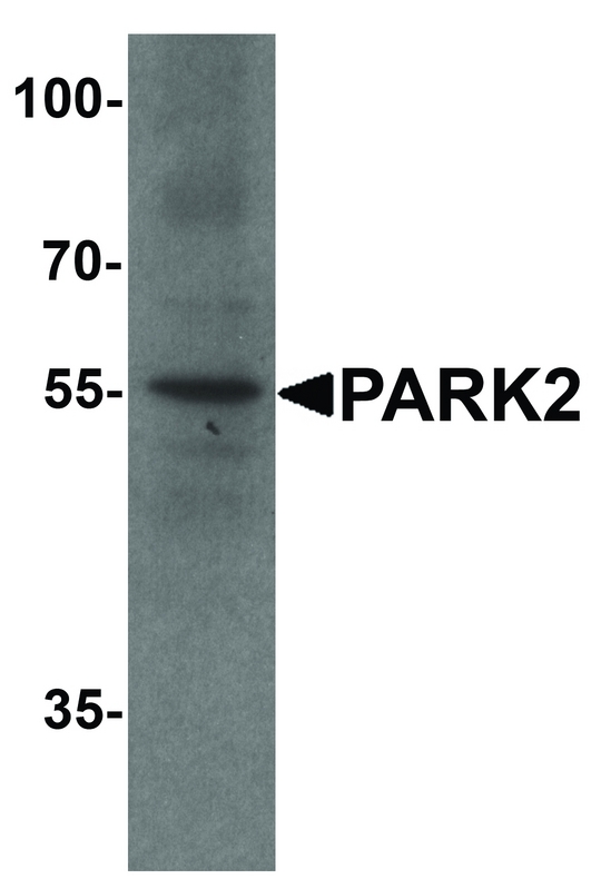 PARK2 / Parkin 2 Antibody - Western blot analysis of PARK2 in human cerebellum tissue lysate with PARK2 antibody at 1 ug/ml.