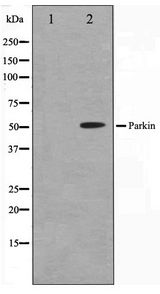 PARK2 / Parkin 2 Antibody - Western blot of HeLa cell lysate using Parkin Antibody
