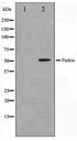 PARK2 / Parkin 2 Antibody - Western blot of HeLa cell lysate using Parkin Antibody