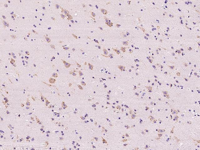 PARK2 / Parkin 2 Antibody - Immunochemical staining of human PARK2 in human brain with rabbit polyclonal antibody at 1:200 dilution, formalin-fixed paraffin embedded sections.