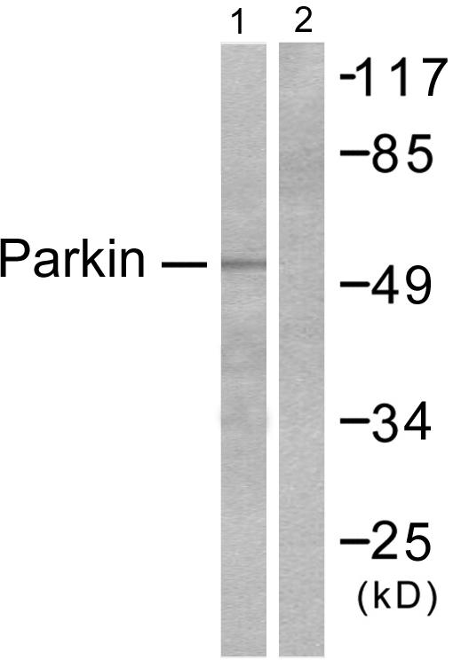 PARK2 / Parkin 2 Antibody - Western blot analysis of extracts from Jukat cells, using Parkin antibody.