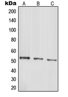 PARK2 / Parkin 2 Antibody - Western blot analysis of Parkin expression in HepG2 (A); SHSY5Y (B); SW480 (C) whole cell lysates.