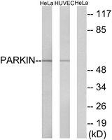 PARK2 / Parkin 2 Antibody - Western blot analysis of extracts from HeLa cells and HUVEC cells, using Parkin (Ab-131) antibody.