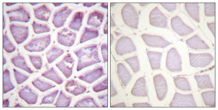PARK2 / Parkin 2 Antibody - Immunohistochemistry analysis of paraffin-embedded human skeletal muscle, using Parkin (Phospho-Ser131) Antibody. The picture on the right is blocked with the phospho peptide.