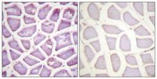 PARK2 / Parkin 2 Antibody - P-peptide - + Immunohistochemistry analysis of paraffin-embedded human skeletal muscle tissue using Parkin (Phospho-Ser131) antibody.