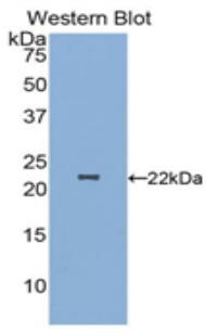 PARK7 / DJ-1 Antibody - Western Blot; Sample: Recombinant protein.