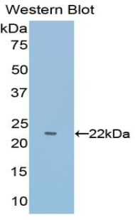 PARK7 / DJ-1 Antibody - Western blot of recombinant PARK7 / DJ-1.  This image was taken for the unconjugated form of this product. Other forms have not been tested.