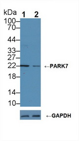 PARK7 / DJ-1 Antibody - Knockout Varification: Lane 1: Wild-type Jurkat cell lysate; Lane 2: PARK7 knockout Jurkat cell lysate; Predicted MW: 20kd Observed MW: 22kd Primary Ab: 2µg/ml Rabbit Anti-Human PARK7 Antibody Second Ab: 0.2µg/mL HRP-Linked Caprine Anti-Rabbit IgG Polyclonal Antibody