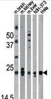 PARK7 / DJ-1 Antibody - Western blot of anti-Park7 (DJ-1) Antibody in mouse brain,kidney,liver tissue lysates and NIH-3T3, HeLa cell line lysates (35 ug/lane). Park7 (arrow) was detected using the purified antibody.