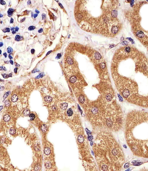 PARK7 / DJ-1 Antibody - Immunohistochemical of paraffin-embedded H. kidney section using PARK7 Antibody. Antibody was diluted at 1:25 dilution. A undiluted biotinylated goat polyvalent antibody was used as the secondary, followed by DAB staining.