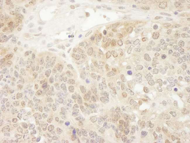 PARK7 / DJ-1 Antibody - Detection of Mouse DJ-1 by Immunohistochemistry. Sample: FFPE section of mouse teratoma. Antibody: Affinity purified rabbit anti-DJ-1 used at a dilution of 1:250. Epitope Retrieval Buffer-High pH (IHC-101J) was substituted for Epitope Retrieval Buffer-Reduced pH.